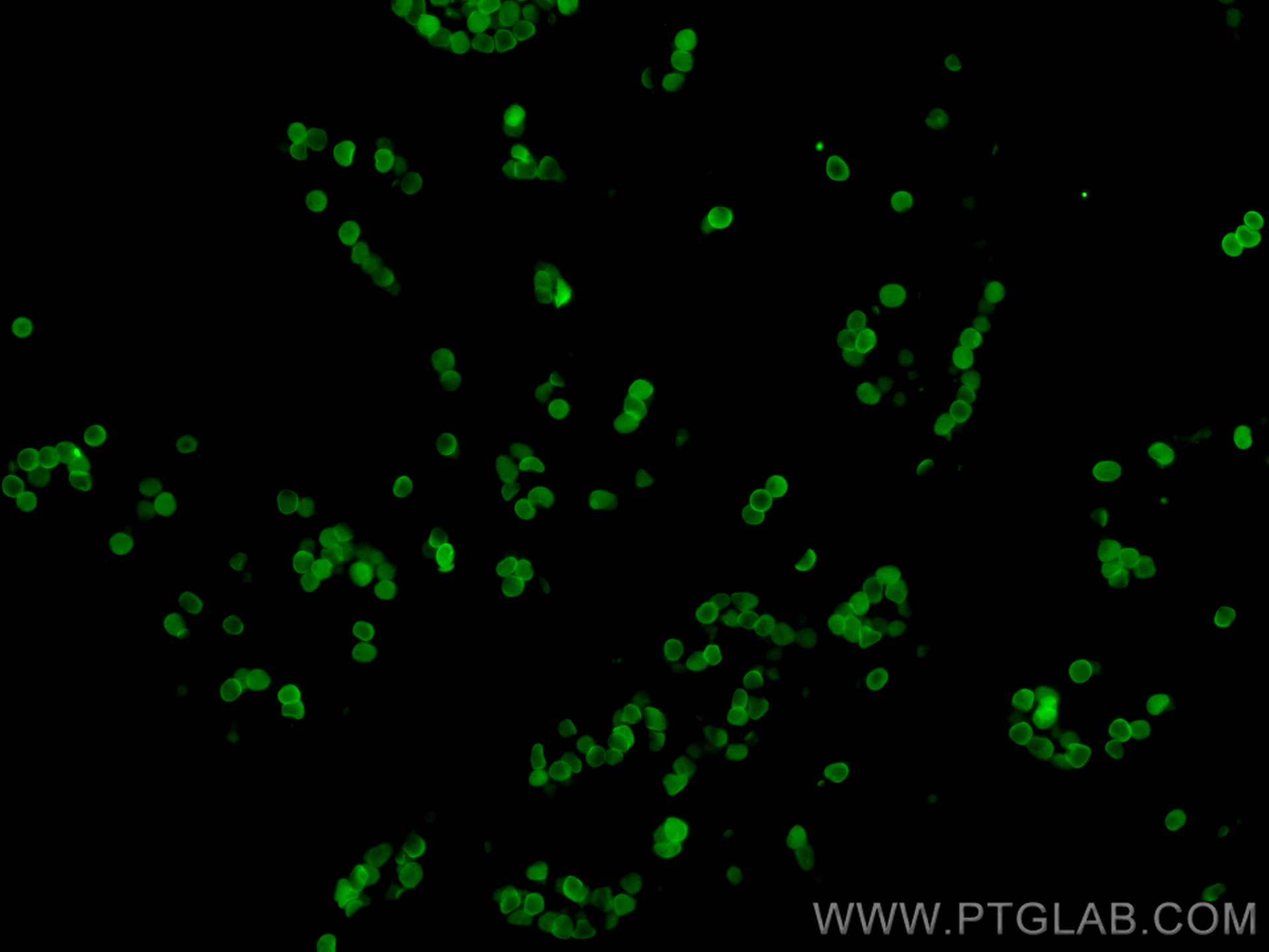 Immunofluorescence (IF) / fluorescent staining of human placenta tissue using CoraLite® Plus 488-conjugated Glycophorin A Polycl (CL488-15874)