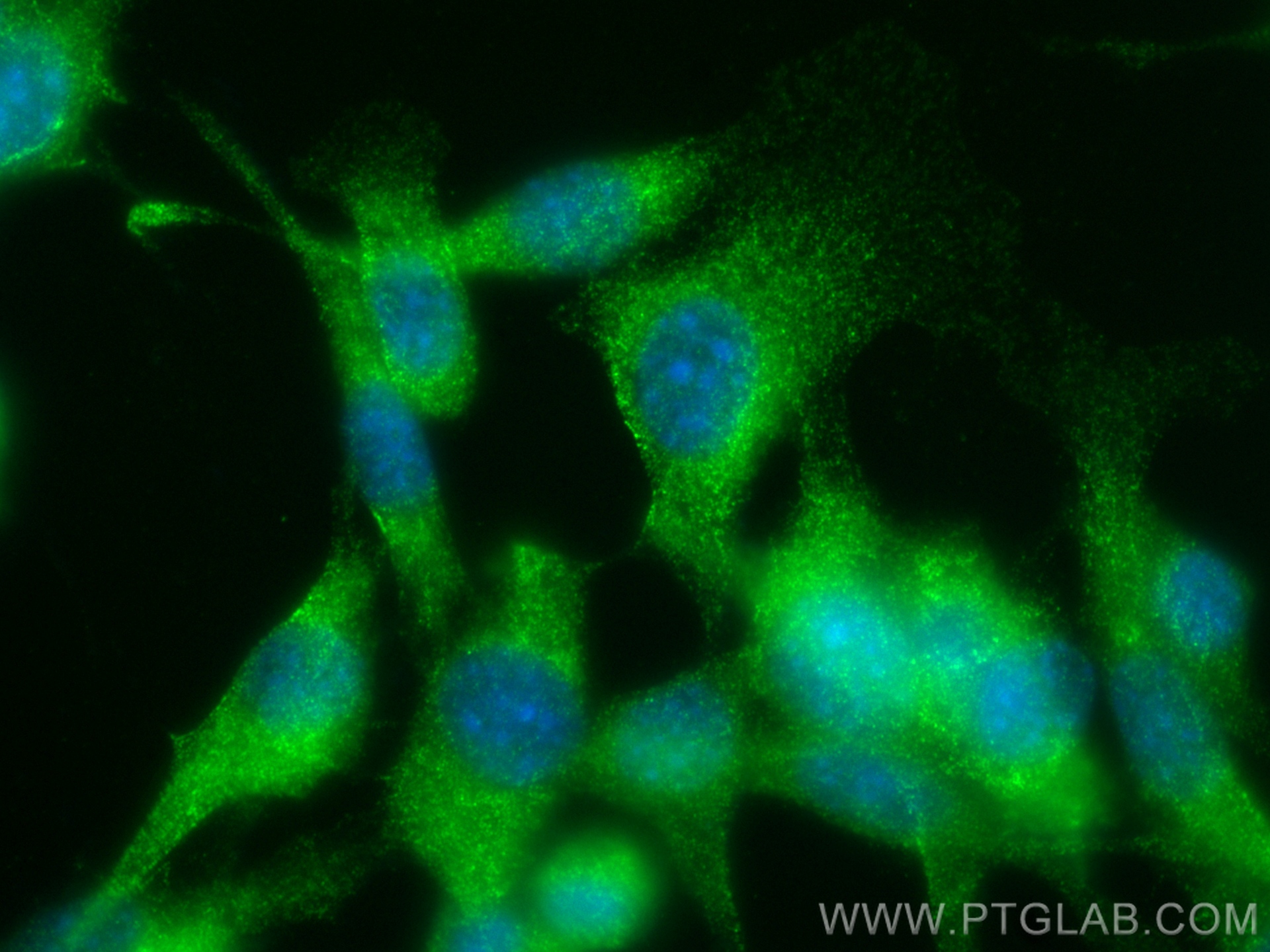 Immunofluorescence (IF) / fluorescent staining of NIH/3T3 cells using GSDMD Recombinant antibody (83562-3-RR)