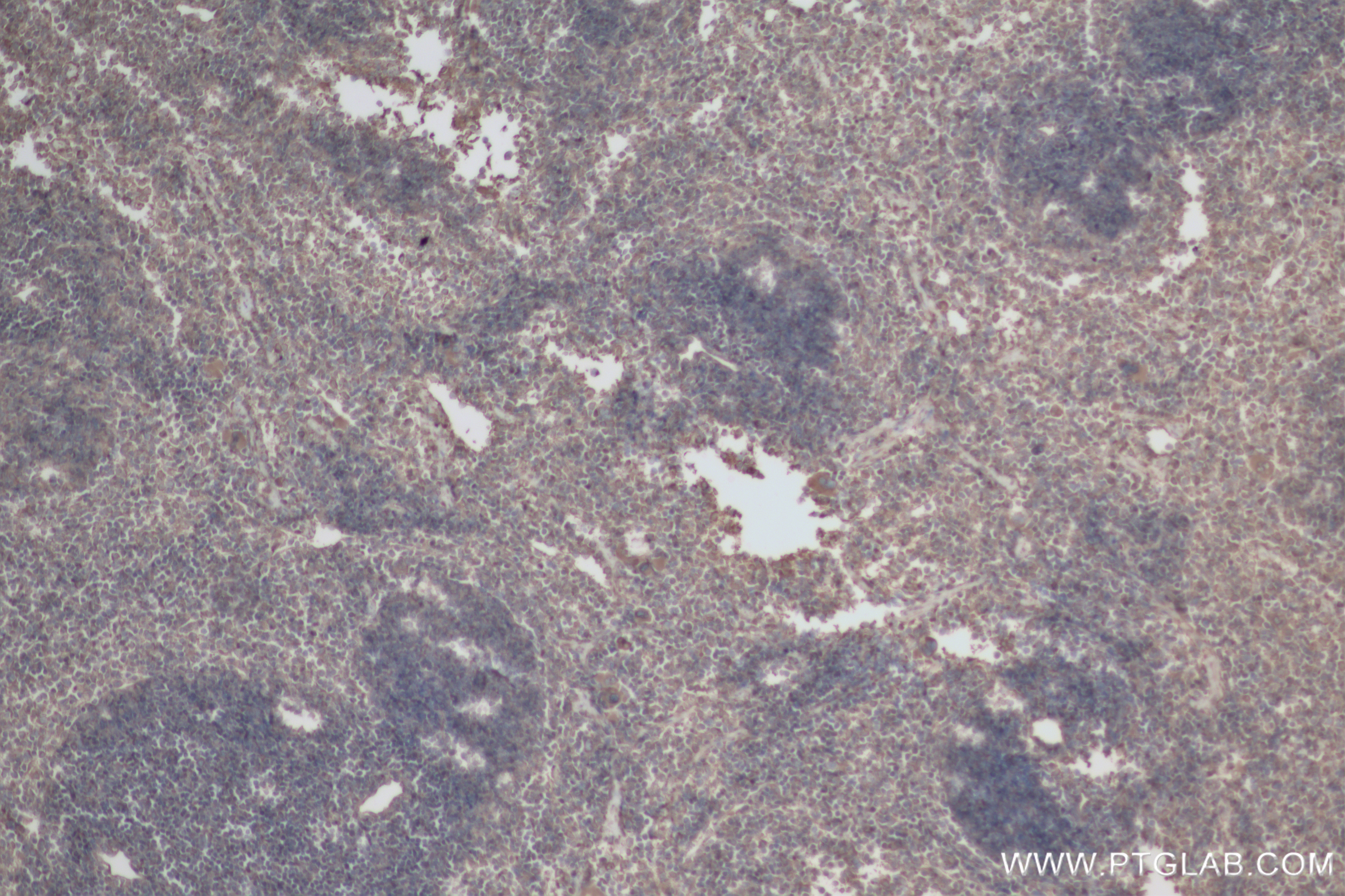 Immunohistochemistry (IHC) staining of mouse spleen tissue using GSDMD Recombinant antibody (83562-3-RR)