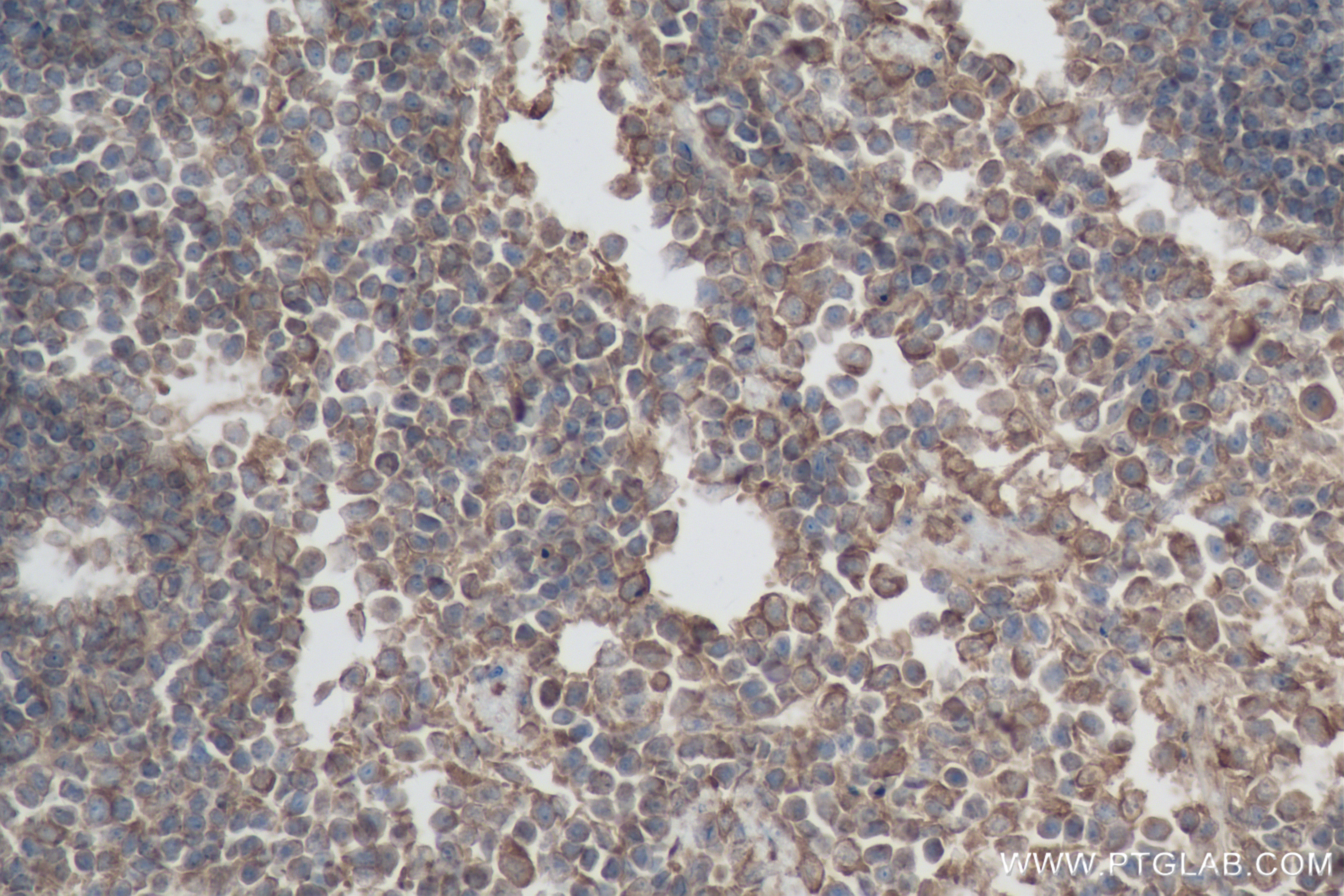 Immunohistochemistry (IHC) staining of mouse spleen tissue using GSDMD Recombinant antibody (83562-3-RR)