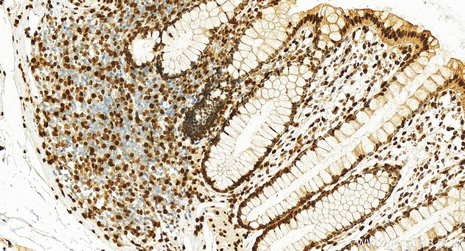 Immunohistochemistry (IHC) staining of human colon tissue using Histone H1.0 Polyclonal antibody (17510-1-AP)