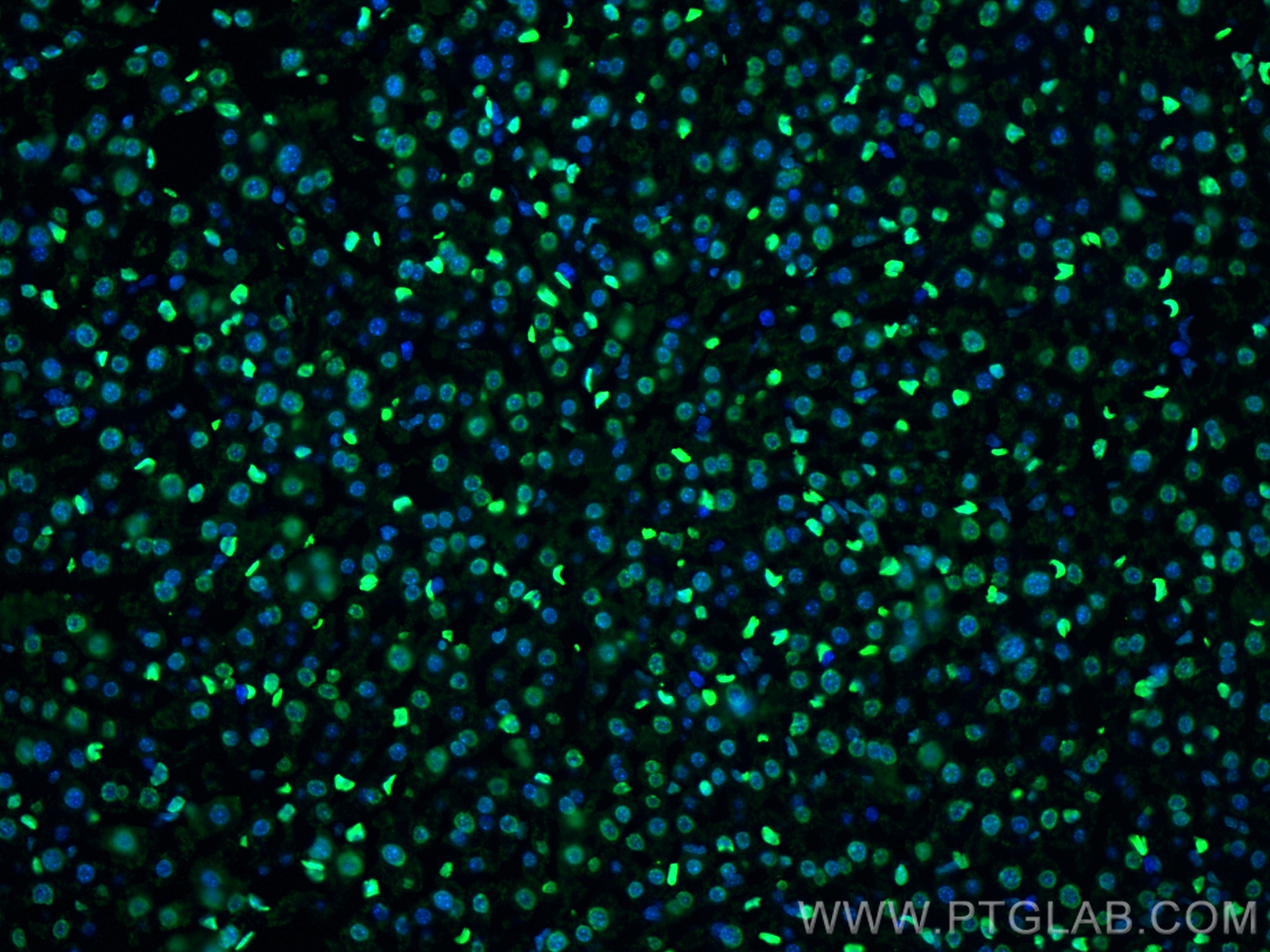 Immunofluorescence (IF) / fluorescent staining of mouse liver tissue using Histone H1.0 Polyclonal antibody (17510-1-AP)