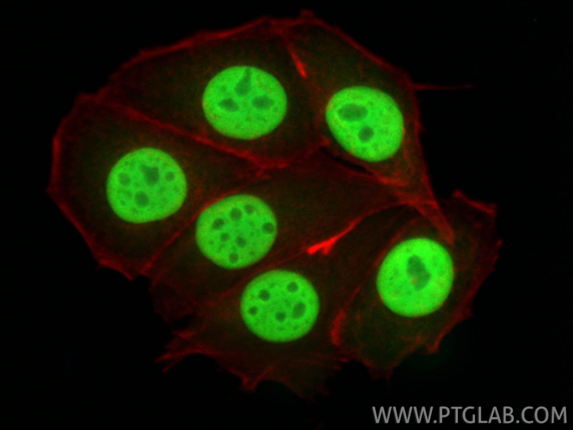 Immunofluorescence (IF) / fluorescent staining of MCF-7 cells using Histone H2A.X Polyclonal antibody (10856-1-AP)