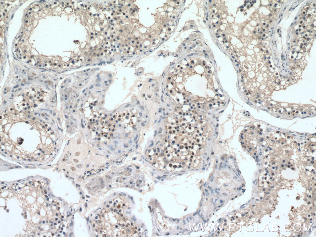 Immunohistochemistry (IHC) staining of human testis tissue using Histone H2A.z Polyclonal antibody (16441-1-AP)