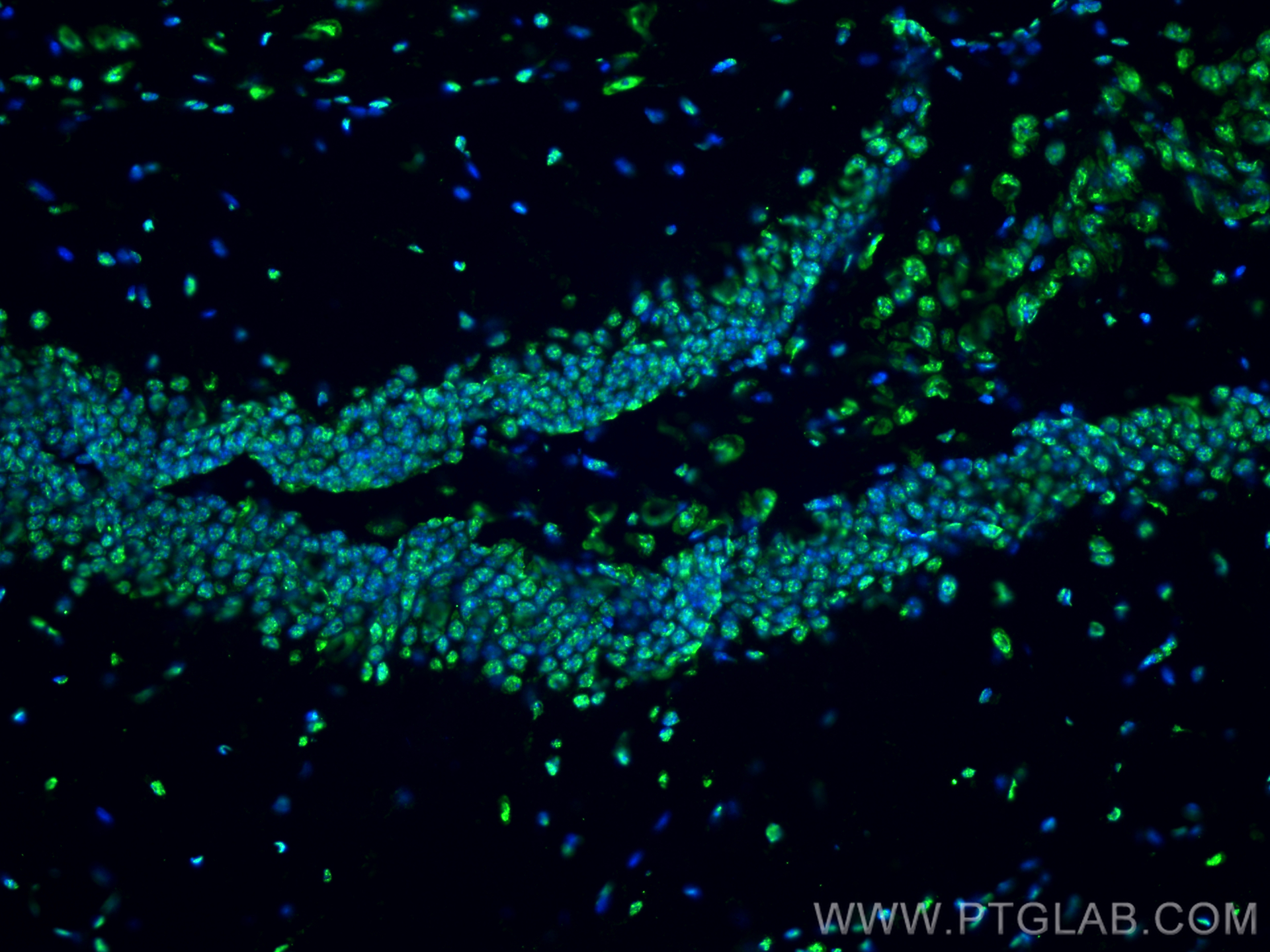 Immunofluorescence (IF) / fluorescent staining of mouse brain tissue using Phospho-Histone H3 (Ser10) Monoclonal antibody (66863-1-Ig)