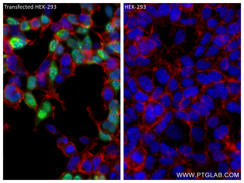 Immunofluorescence (IF) / fluorescent staining of Transfected HEK-293 cells using HA Tag Recombinant antibody (81290-1-RR)