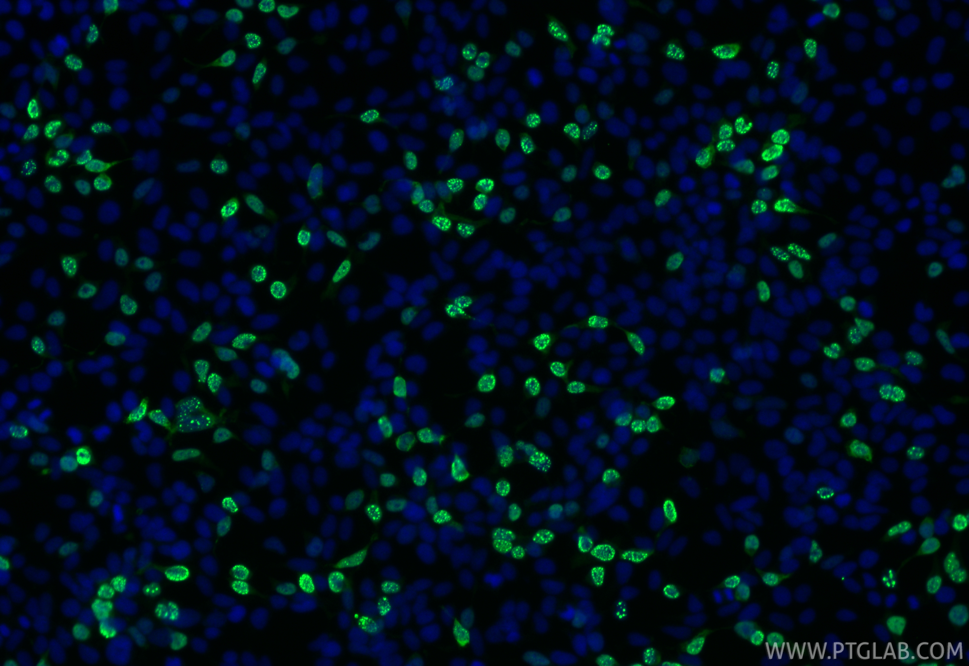 Immunofluorescence (IF) / fluorescent staining of Transfected HEK-293 cells using HA tag Polyclonal antibody (51064-2-AP)