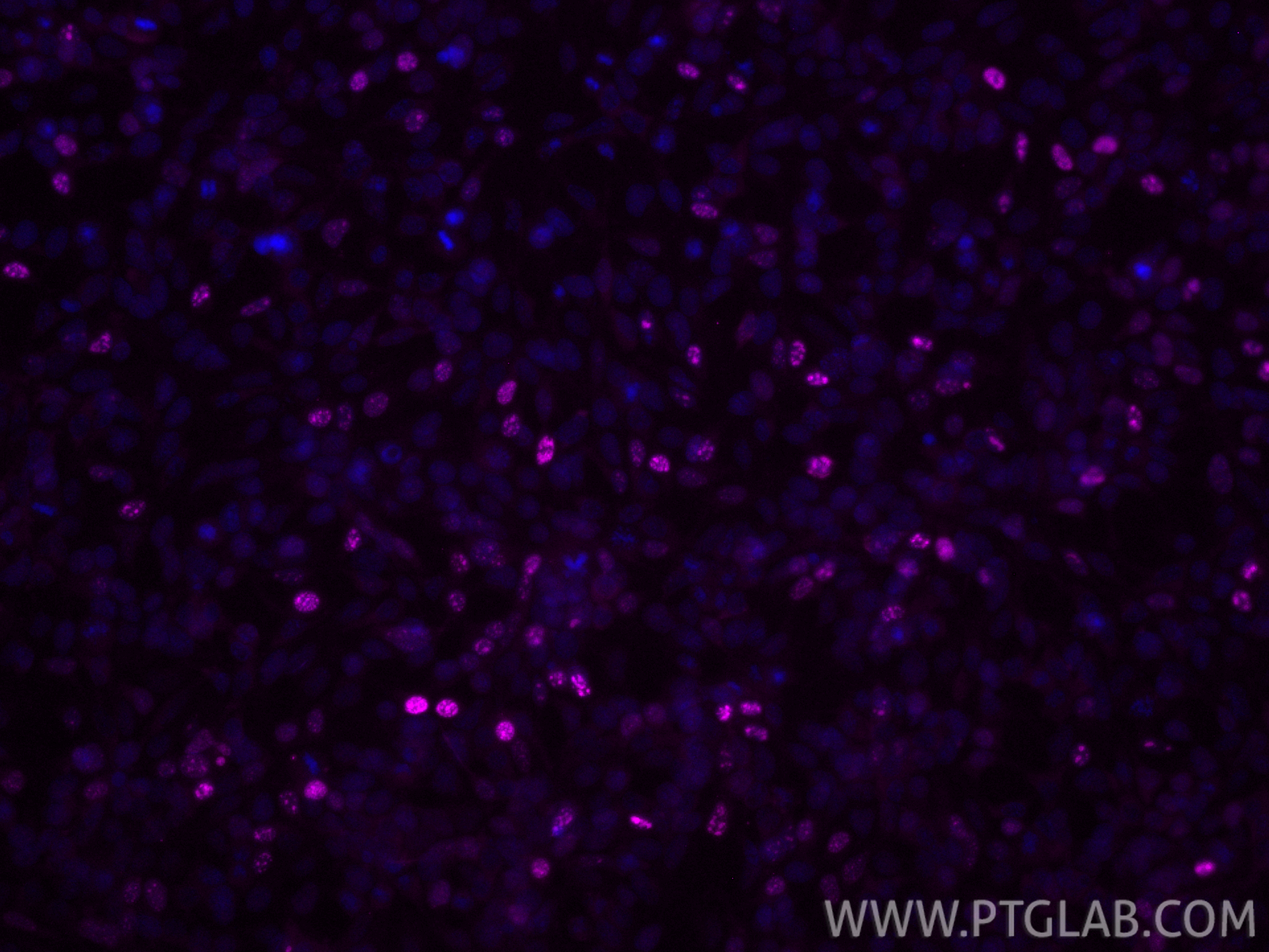 Immunofluorescence (IF) / fluorescent staining of Transfected HEK-293 cells using CoraLite® Plus 647-conjugated HA tag Polyclonal an (CL647-51064-2)