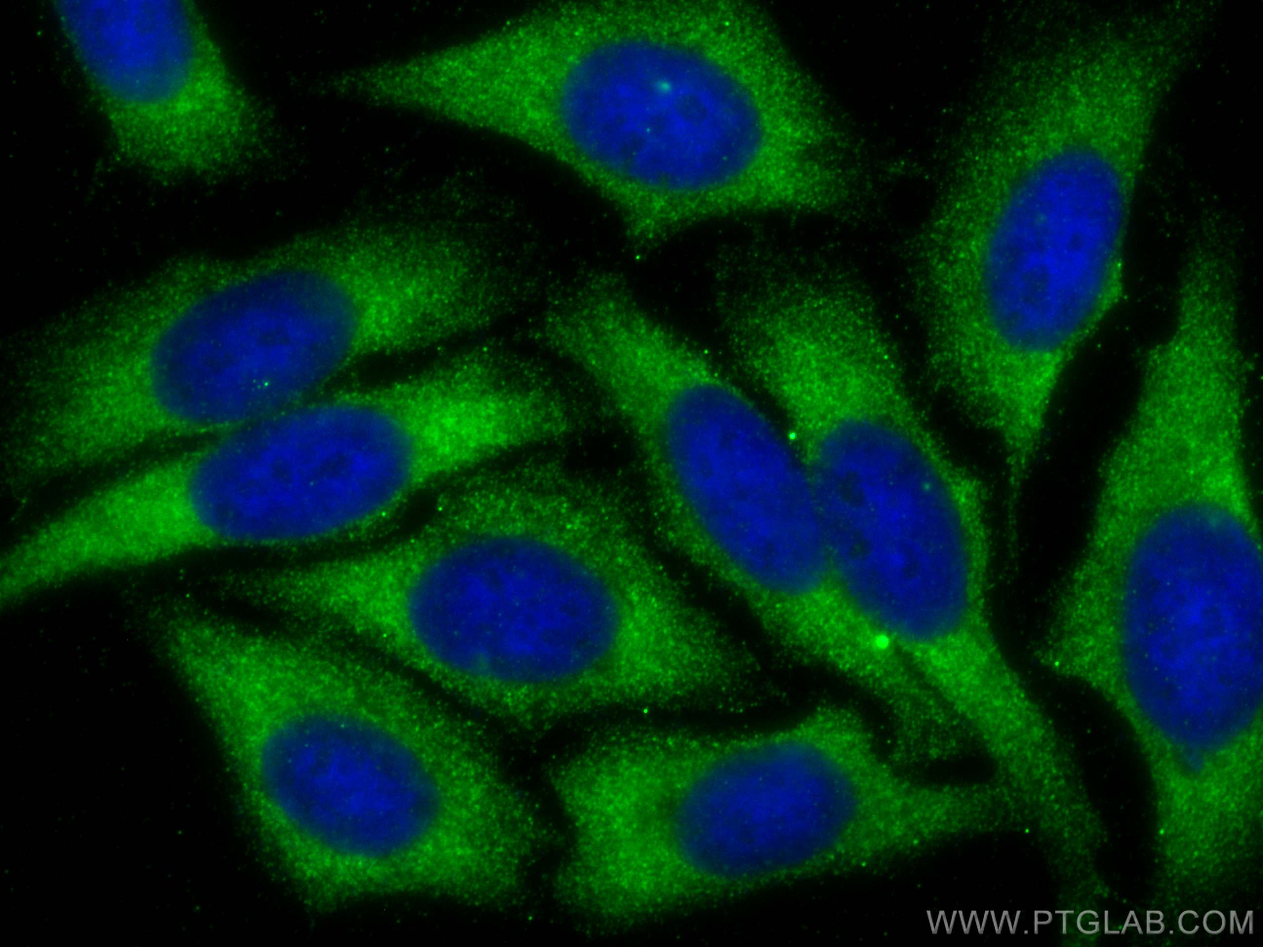 Immunofluorescence (IF) / fluorescent staining of HepG2 cells using HABP2 Monoclonal antibody (67867-1-Ig)