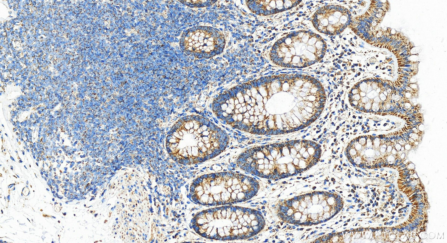 Immunohistochemistry (IHC) staining of human colon tissue using HADHA Polyclonal antibody (10758-1-AP)