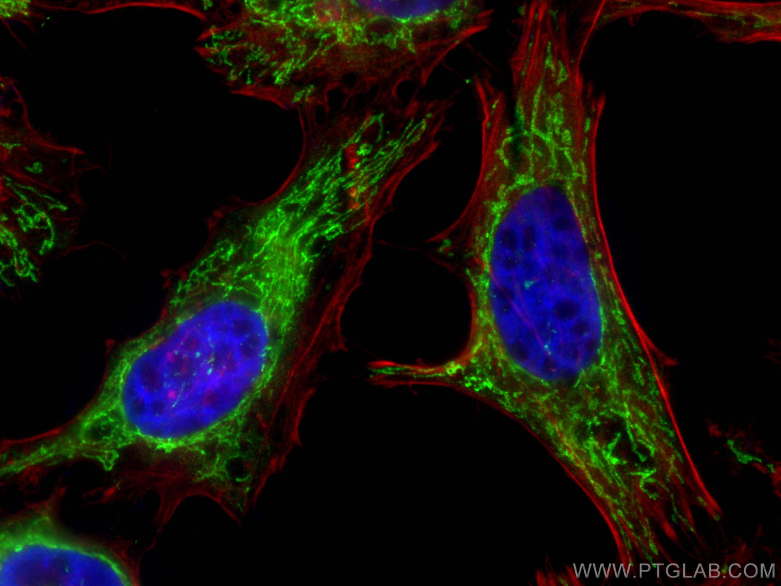 Immunofluorescence (IF) / fluorescent staining of HeLa cells using HADHA Polyclonal antibody (10758-1-AP)