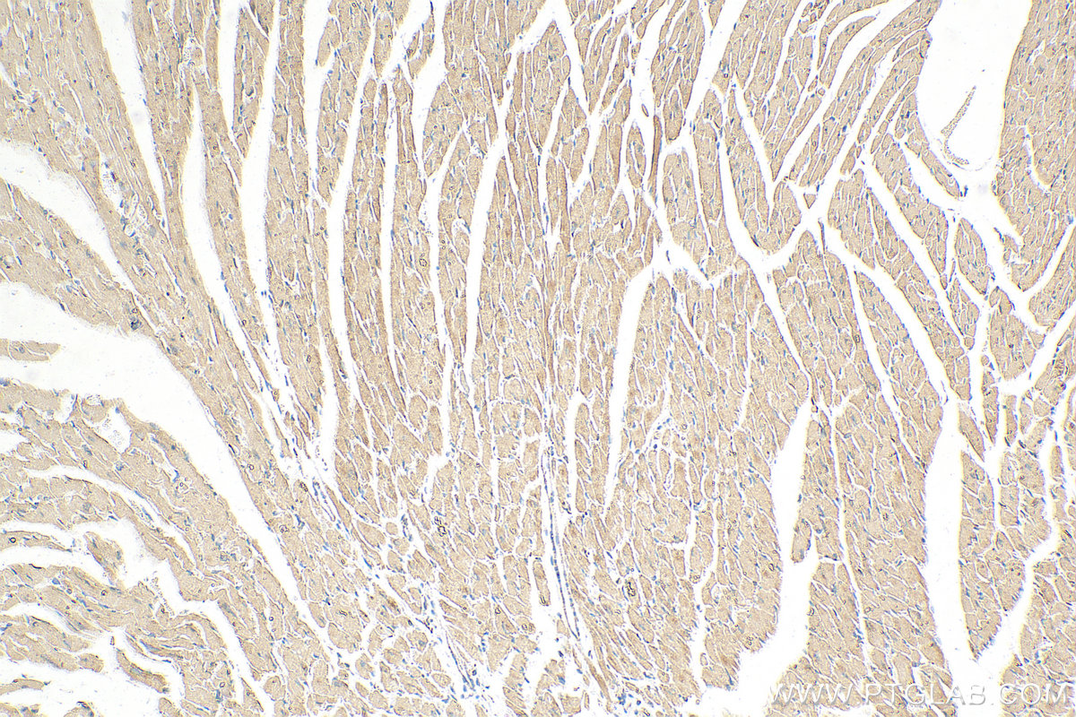 Immunohistochemistry (IHC) staining of mouse heart tissue using HADHA Monoclonal antibody (60250-1-Ig)