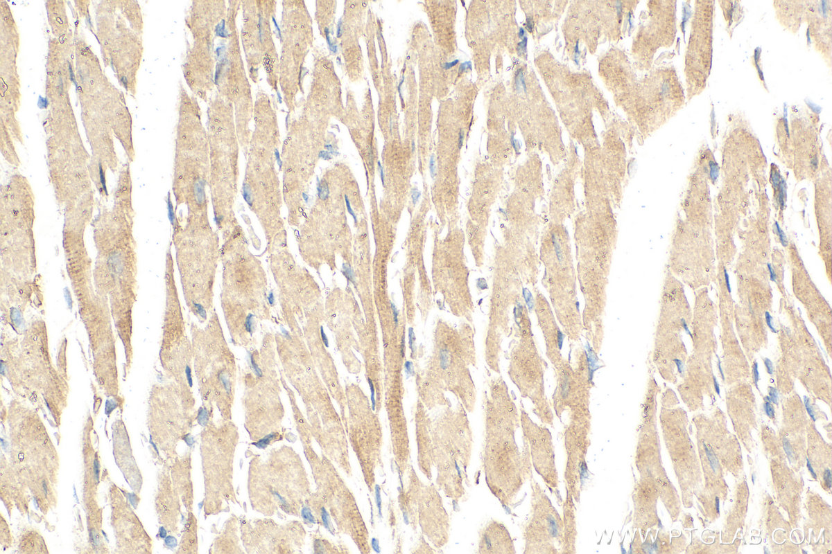 Immunohistochemistry (IHC) staining of mouse heart tissue using HADHA Monoclonal antibody (60250-1-Ig)