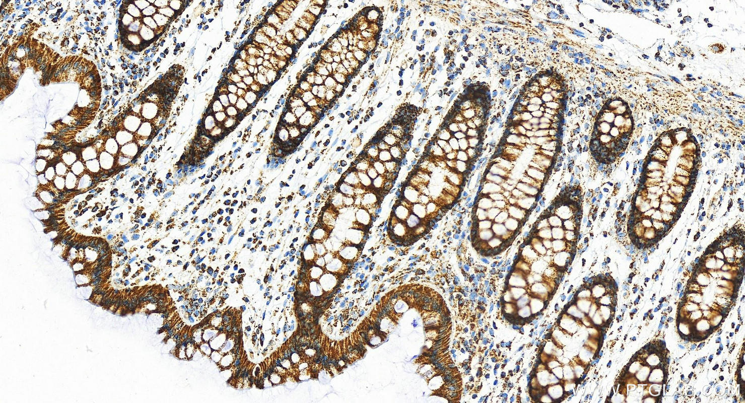 Immunohistochemistry (IHC) staining of human  colon using HADHB Polyclonal antibody (29091-1-AP)