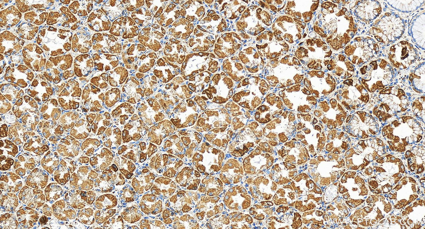 Immunohistochemistry (IHC) staining of human stomach tissue using HADHB Polyclonal antibody (29091-1-AP)