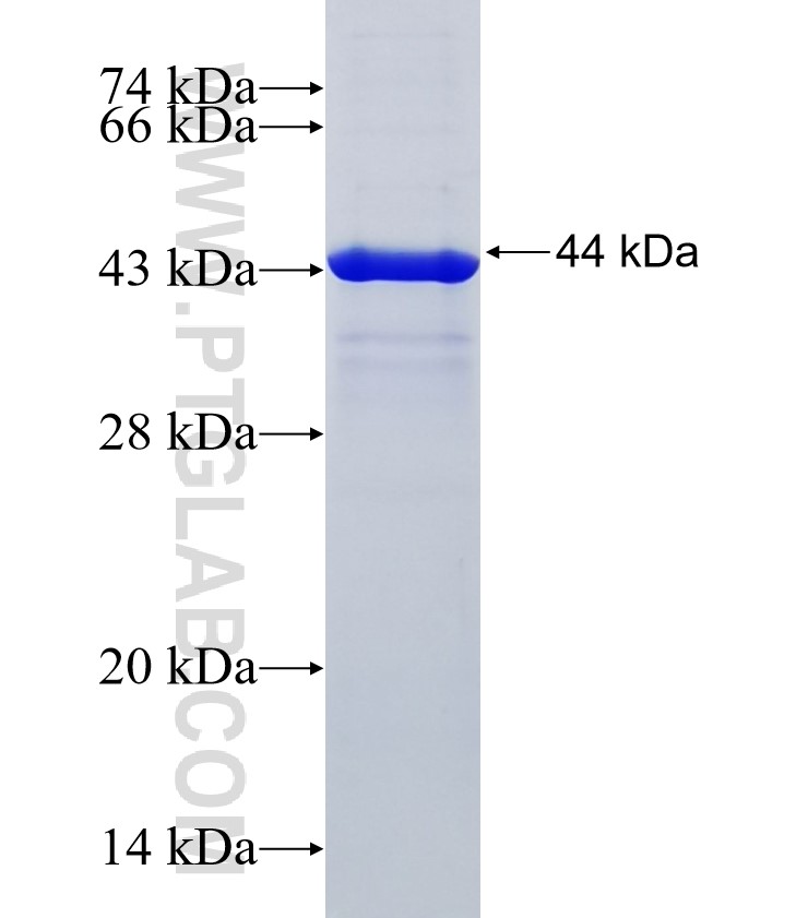 HAPLN1 fusion protein Ag35652 SDS-PAGE