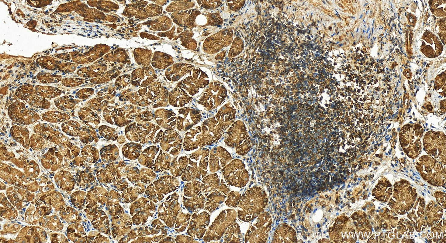 Immunohistochemistry (IHC) staining of human stomach tissue using HARS Polyclonal antibody (16375-1-AP)