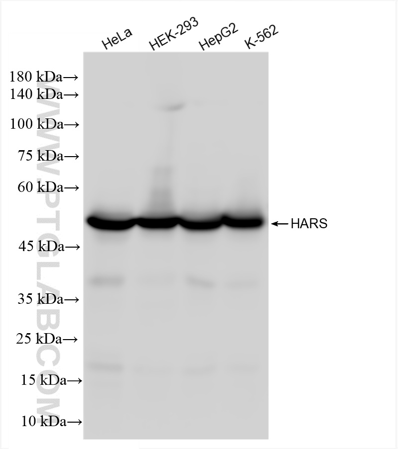 Western Blot (WB) analysis of various lysates using HARS Recombinant antibody (83497-1-RR)