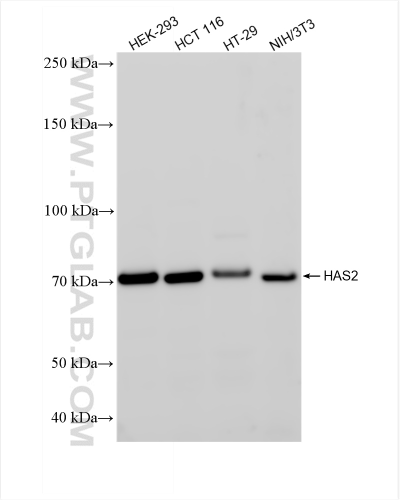 Western Blot (WB) analysis of various lysates using HAS2 Recombinant antibody (83204-2-RR)