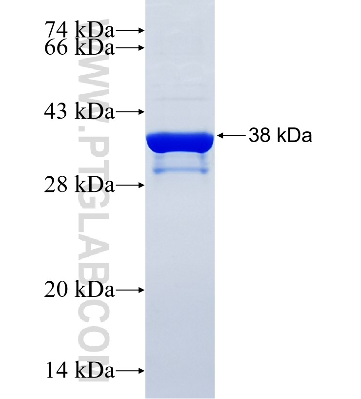 HAS2 fusion protein Ag34945 SDS-PAGE