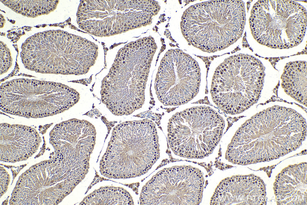 Immunohistochemistry (IHC) staining of rat testis tissue using HAT1 Monoclonal antibody (67971-1-Ig)