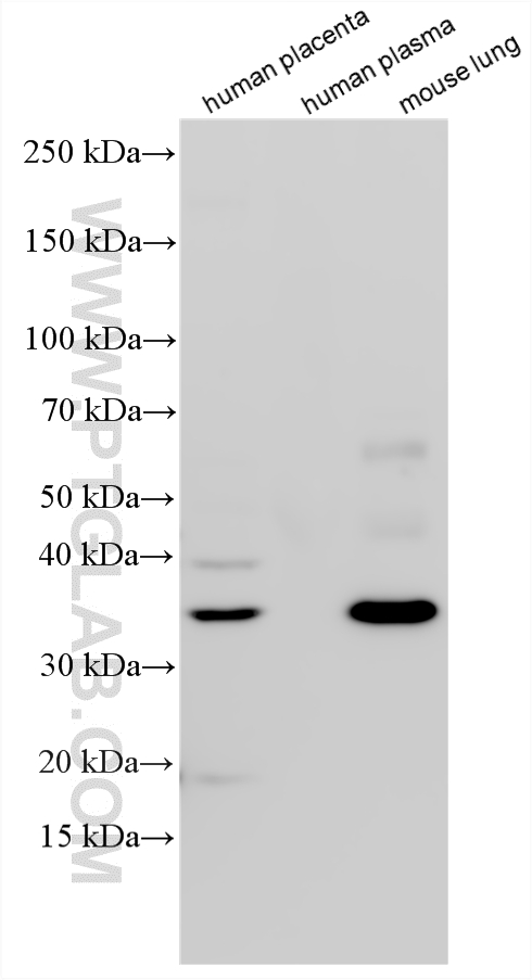 Western Blot (WB) analysis of various lysates using HAUS4 Polyclonal antibody (20104-1-AP)