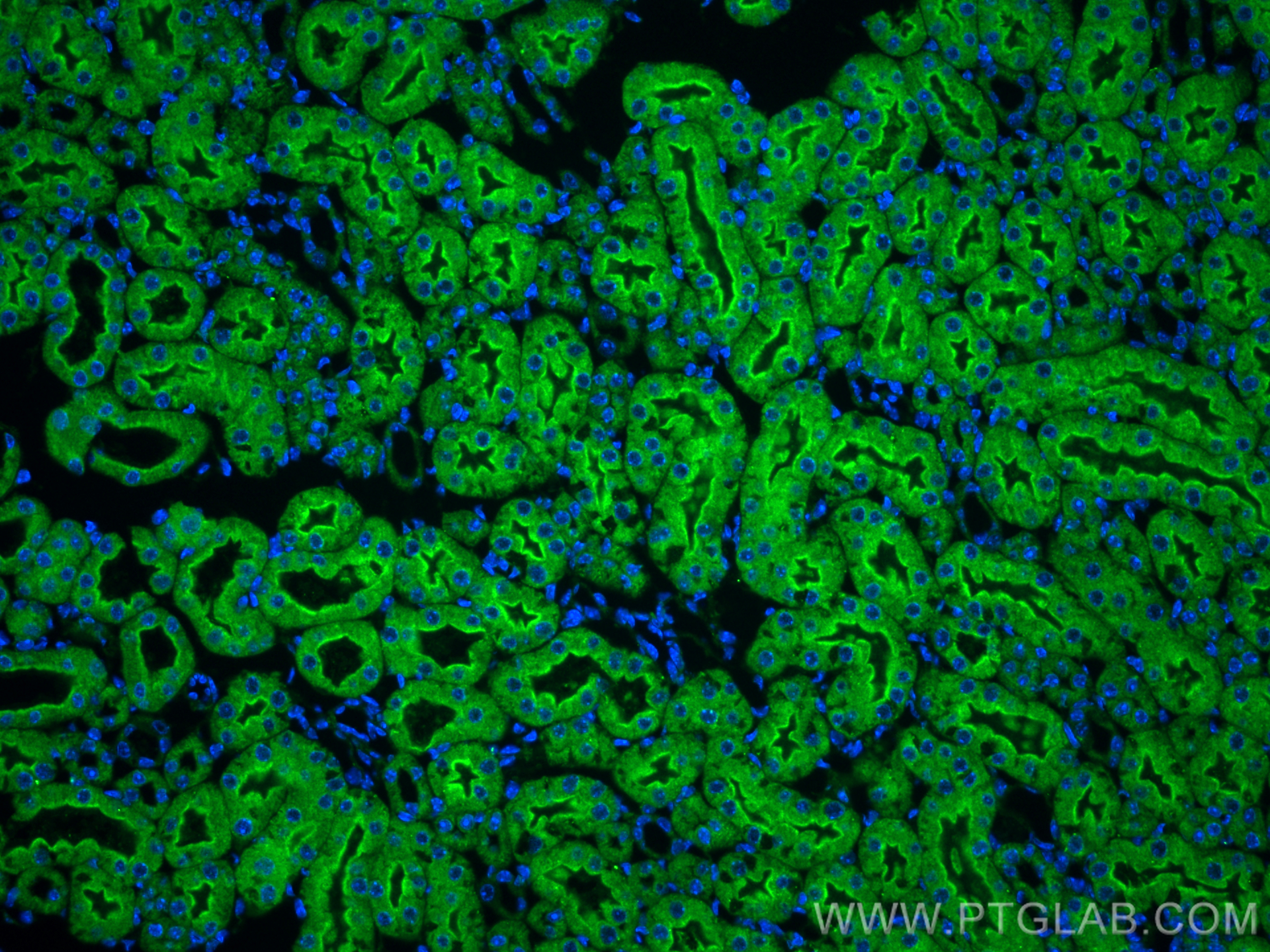 Immunofluorescence (IF) / fluorescent staining of mouse kidney tissue using KIM-1/HAVCR1 Polyclonal antibody (30948-1-AP)