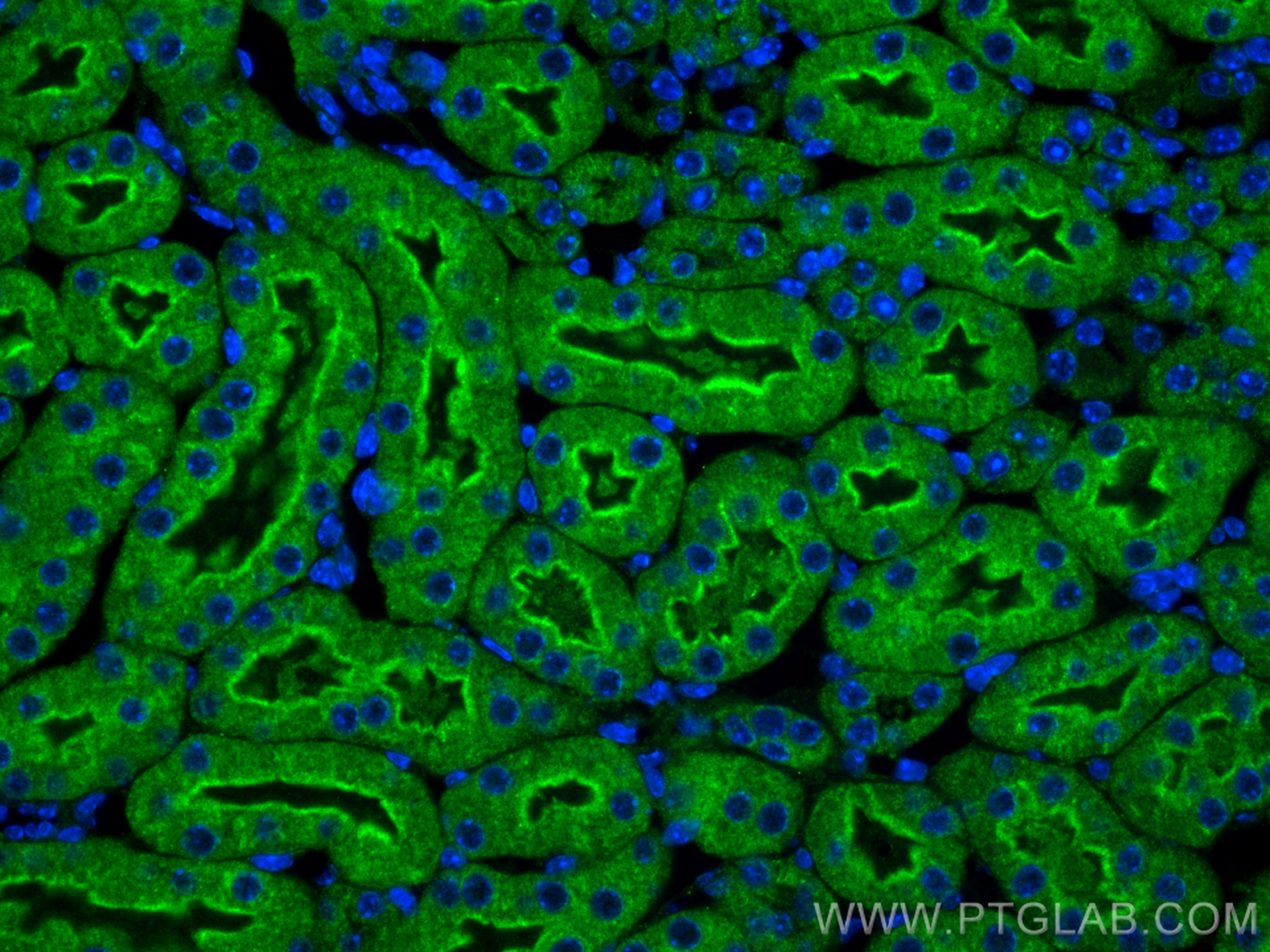 Immunofluorescence (IF) / fluorescent staining of mouse kidney tissue using KIM-1/HAVCR1 Polyclonal antibody (30948-1-AP)