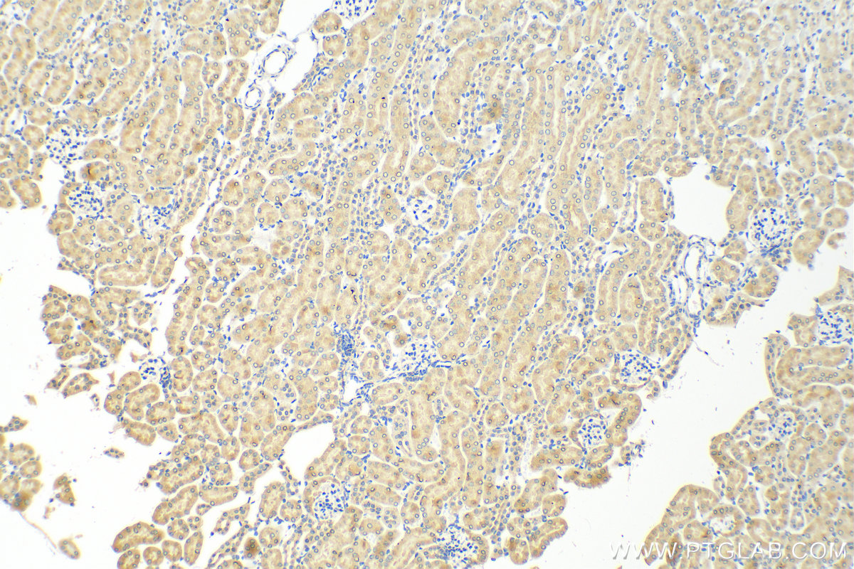 Immunohistochemistry (IHC) staining of mouse kidney tissue using KIM-1/HAVCR1 Polyclonal antibody (30948-1-AP)