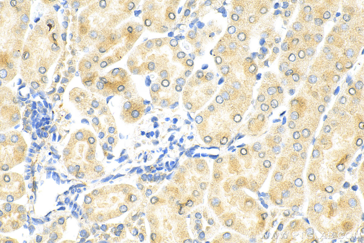 Immunohistochemistry (IHC) staining of mouse kidney tissue using KIM-1/HAVCR1 Polyclonal antibody (30948-1-AP)