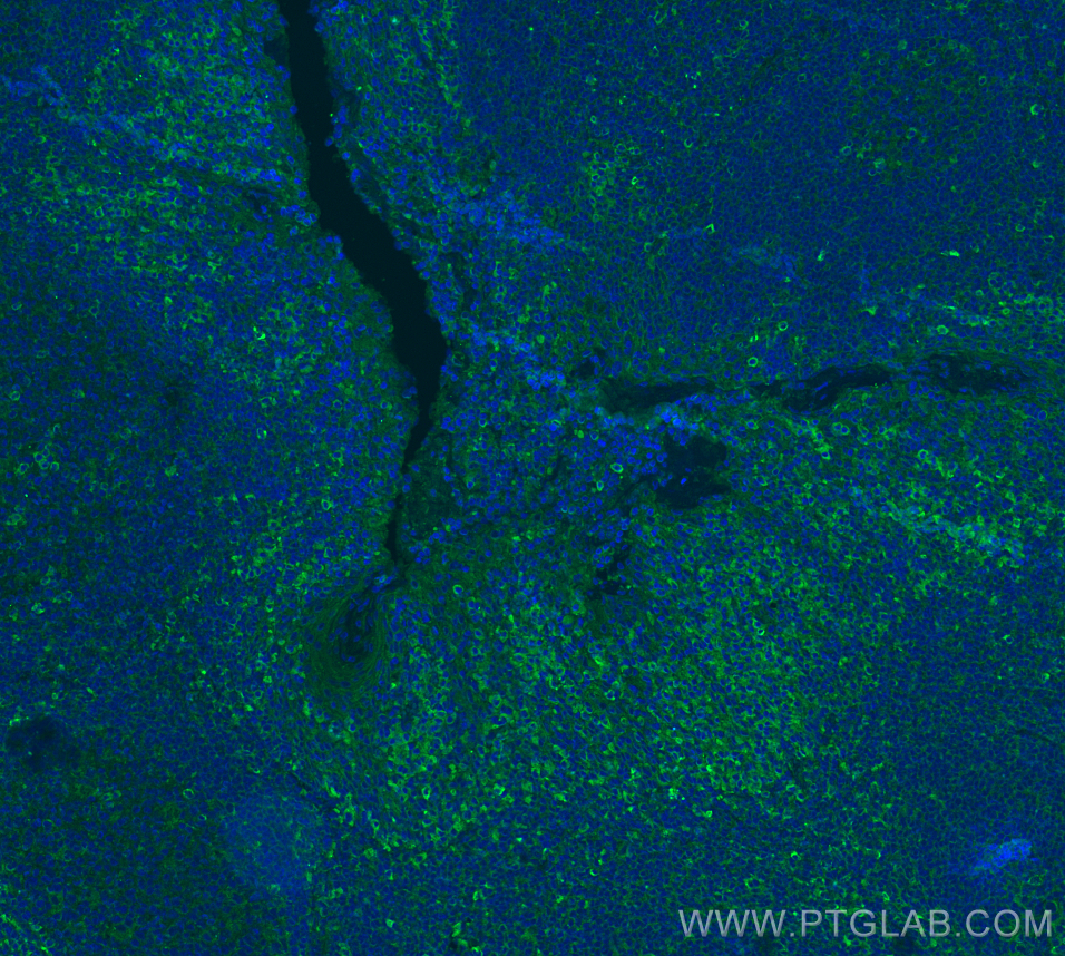 Immunofluorescence (IF) / fluorescent staining of human tonsillitis tissue using TIM3 Polyclonal antibody (11872-1-AP)