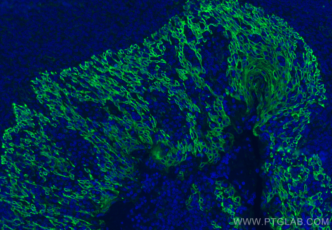 Immunofluorescence (IF) / fluorescent staining of human tonsillitis tissue using TIM3 Monoclonal antibody (60355-1-Ig)