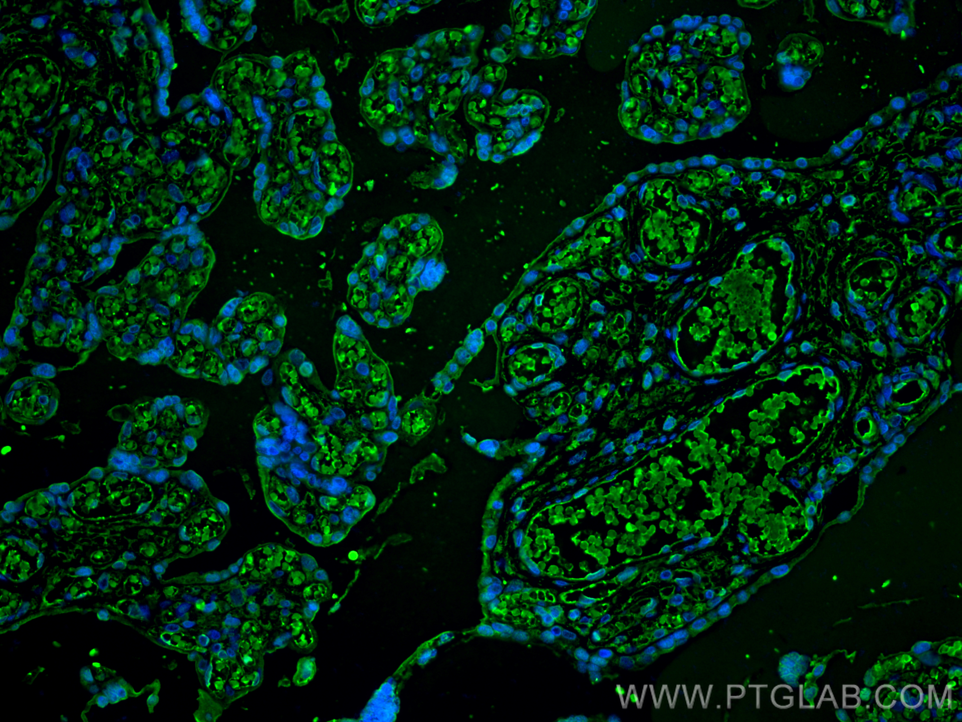 Immunofluorescence (IF) / fluorescent staining of human placenta tissue using Hemoglobin Alpha Polyclonal antibody (14537-1-AP)