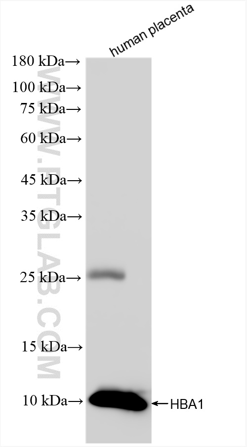 Western Blot (WB) analysis of human placenta tissue using HBA1 Recombinant antibody (83185-5-RR)