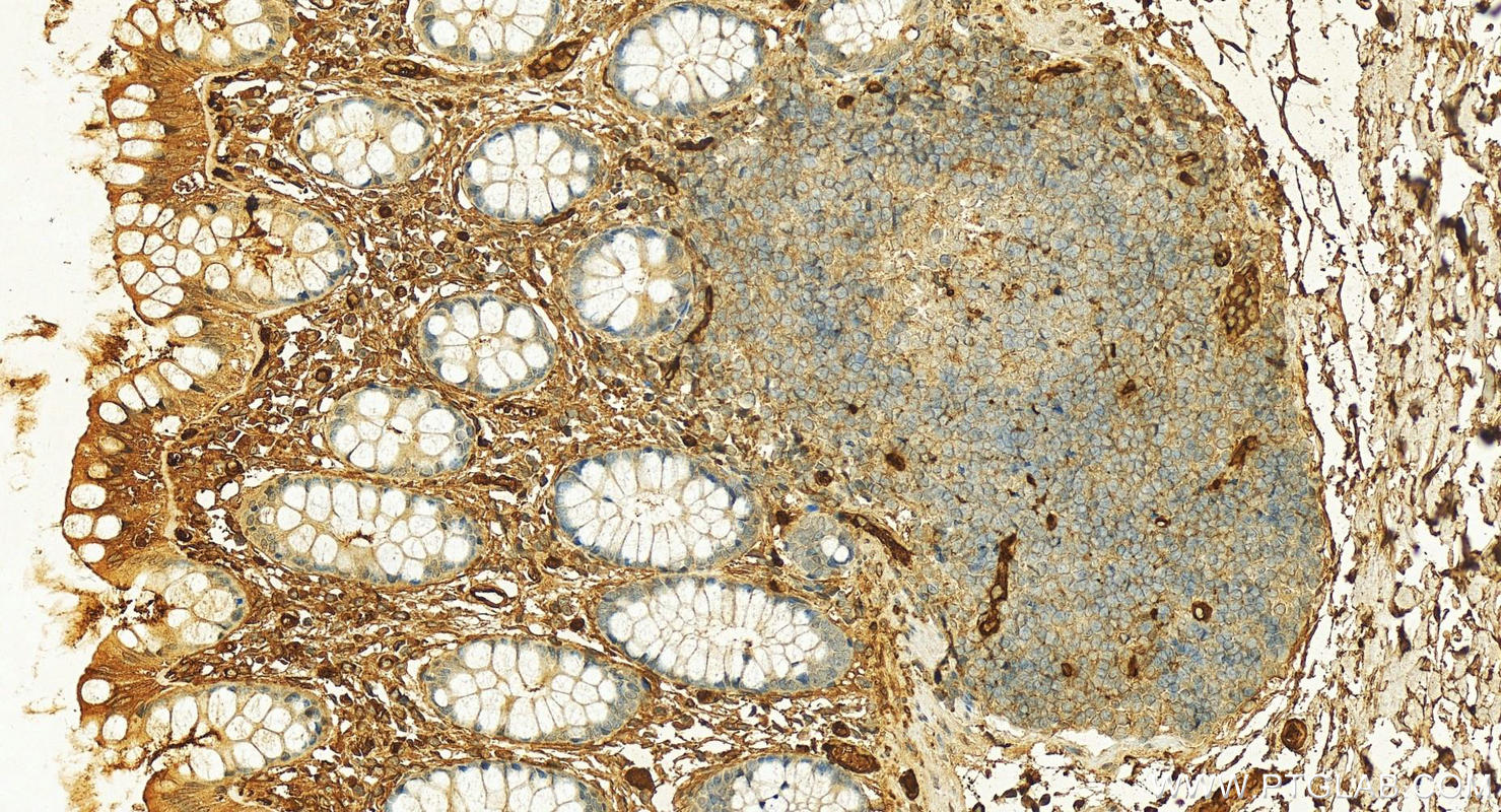 Immunohistochemistry (IHC) staining of human  colon using Hemoglobin Alpha-Specific Polyclonal antibody (19990-1-AP)