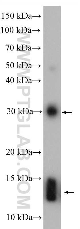 Western Blot (WB) analysis of human placenta tissue using Hemoglobin Alpha-Specific Polyclonal antibody (19990-1-AP)