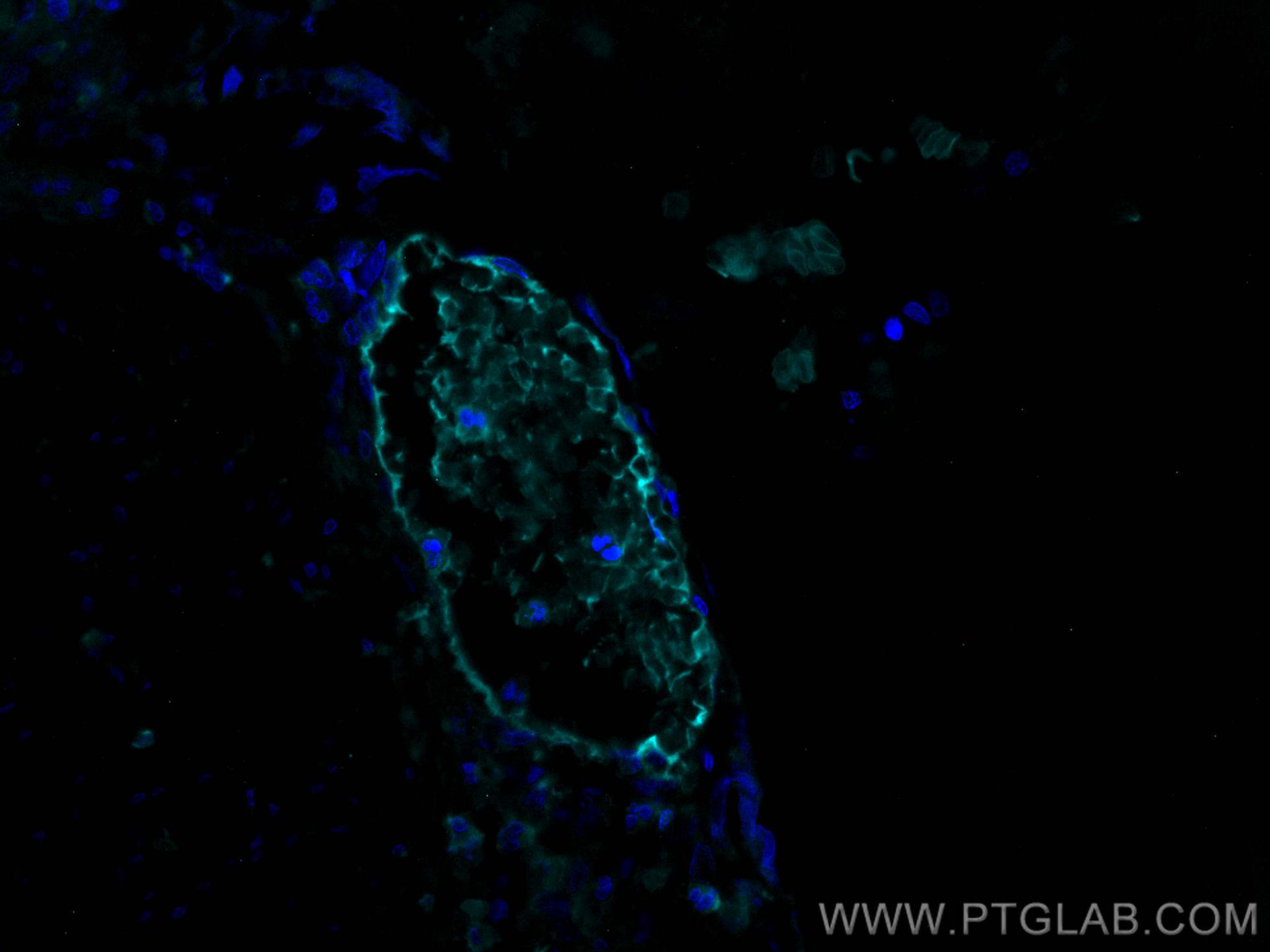 Immunofluorescence (IF) / fluorescent staining of human appendicitis tissue using CoraLite® Plus 750-conjugated HBB Polyclonal antib (CL750-16216)