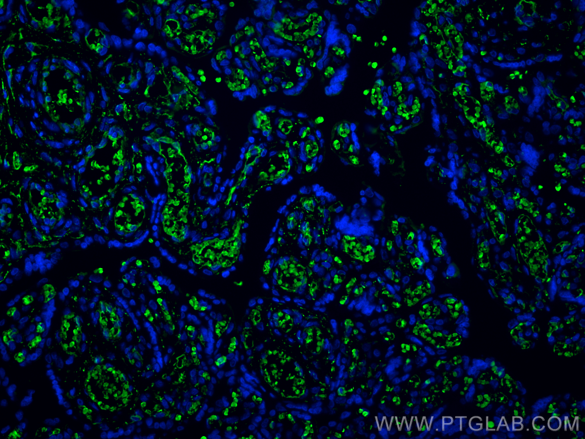 Immunofluorescence (IF) / fluorescent staining of human placenta tissue using Hemoglobin Epsilon Polyclonal antibody (12361-1-AP)