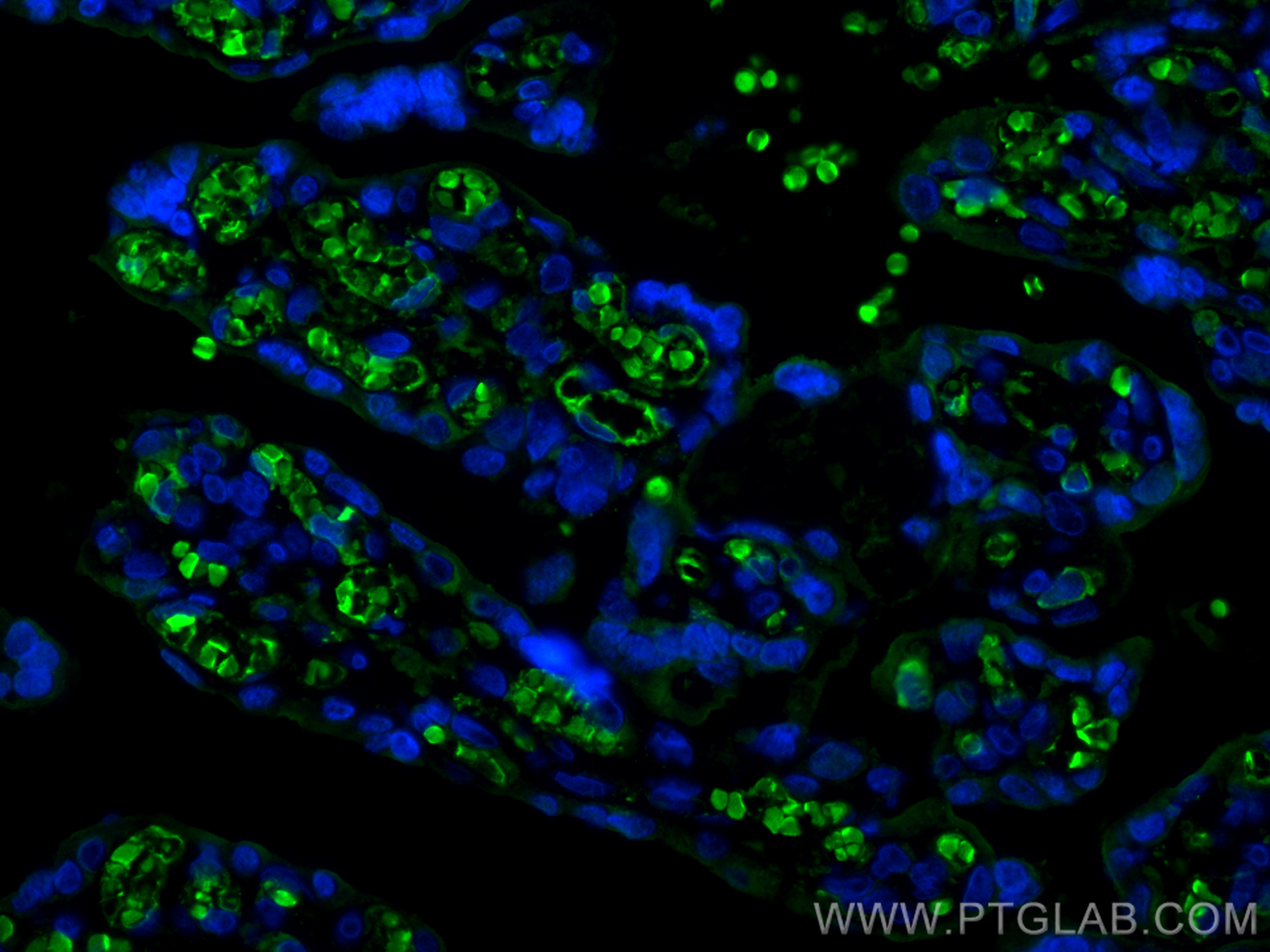 Immunofluorescence (IF) / fluorescent staining of human placenta tissue using Hemoglobin Epsilon Polyclonal antibody (12361-1-AP)