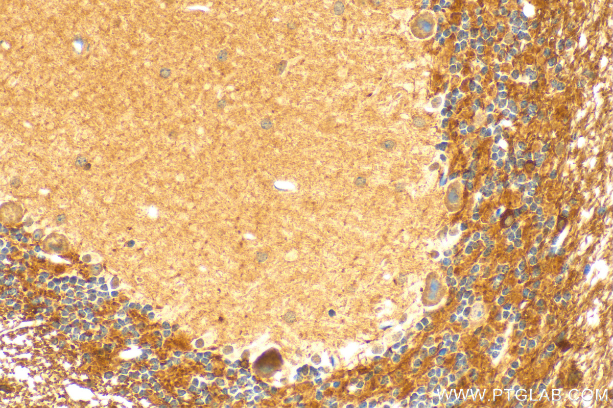 Immunohistochemistry (IHC) staining of mouse cerebellum tissue using HCN2 Polyclonal antibody (30946-1-AP)