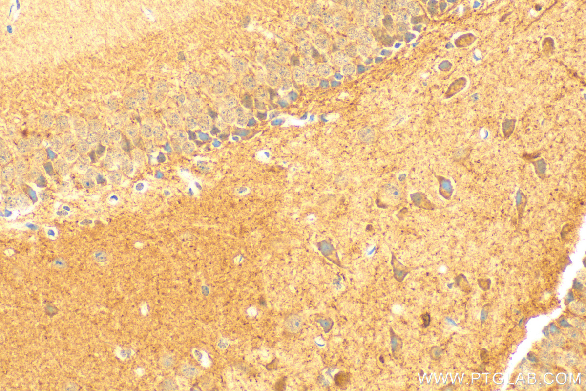 Immunohistochemistry (IHC) staining of mouse brain tissue using HCN2 Polyclonal antibody (30946-1-AP)