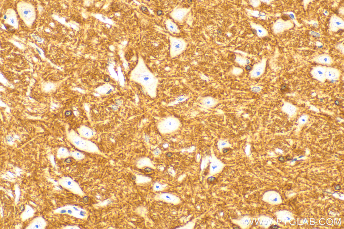 Immunohistochemistry (IHC) staining of mouse cerebellum tissue using HCN2 Polyclonal antibody (30946-1-AP)