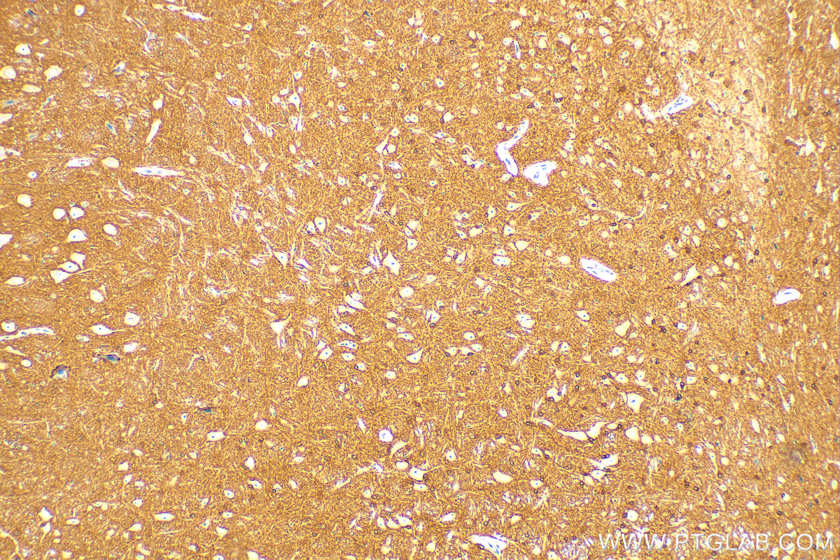 Immunohistochemistry (IHC) staining of mouse cerebellum tissue using HCN2 Polyclonal antibody (30946-1-AP)