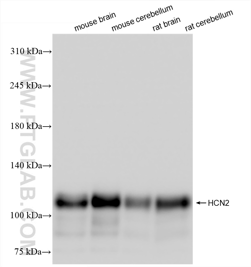 Western Blot (WB) analysis of various lysates using HCN2 Recombinant antibody (84308-3-RR)