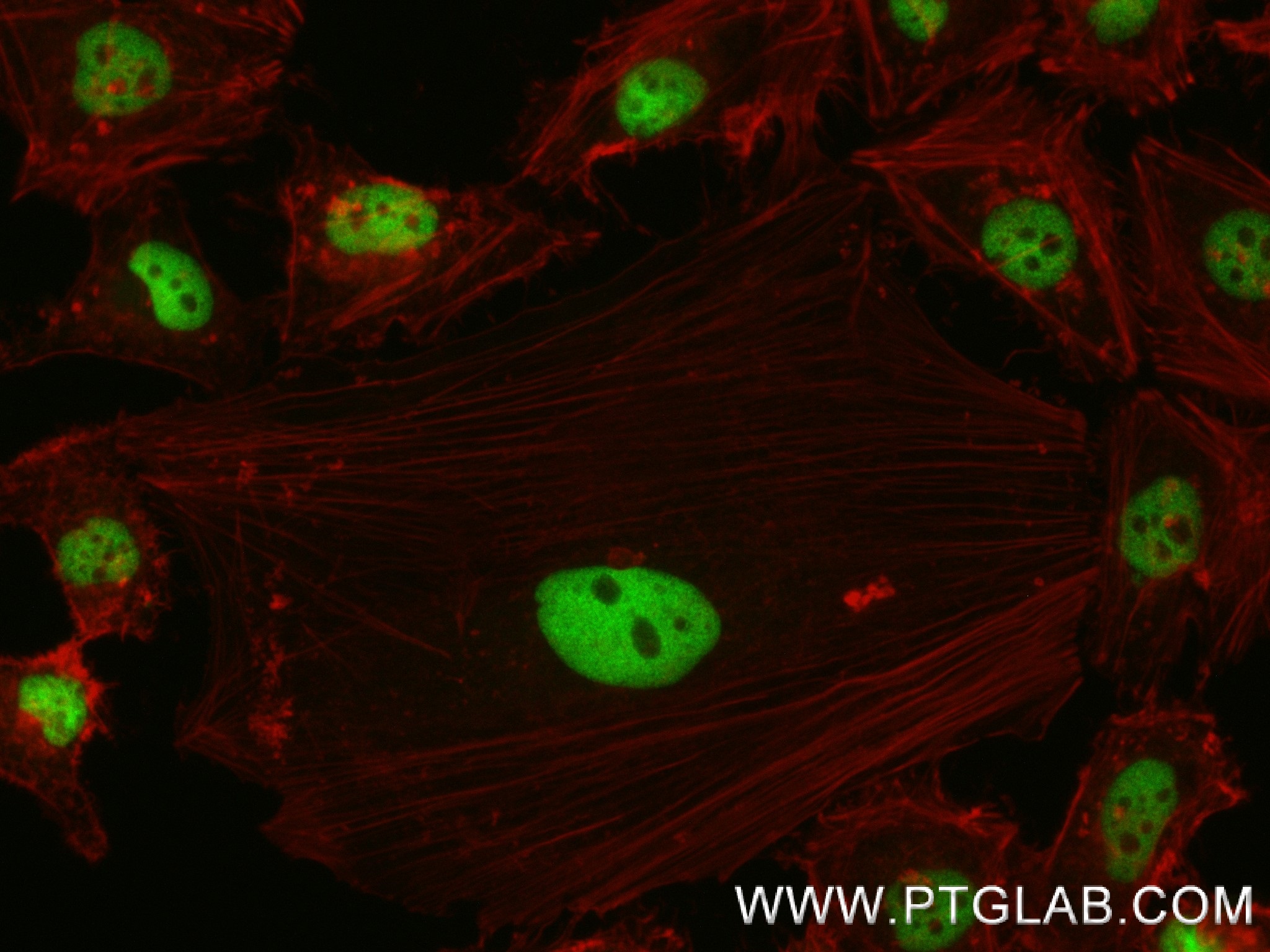 Immunofluorescence (IF) / fluorescent staining of HeLa cells using HDAC1 Recombinant antibody (83624-1-RR)