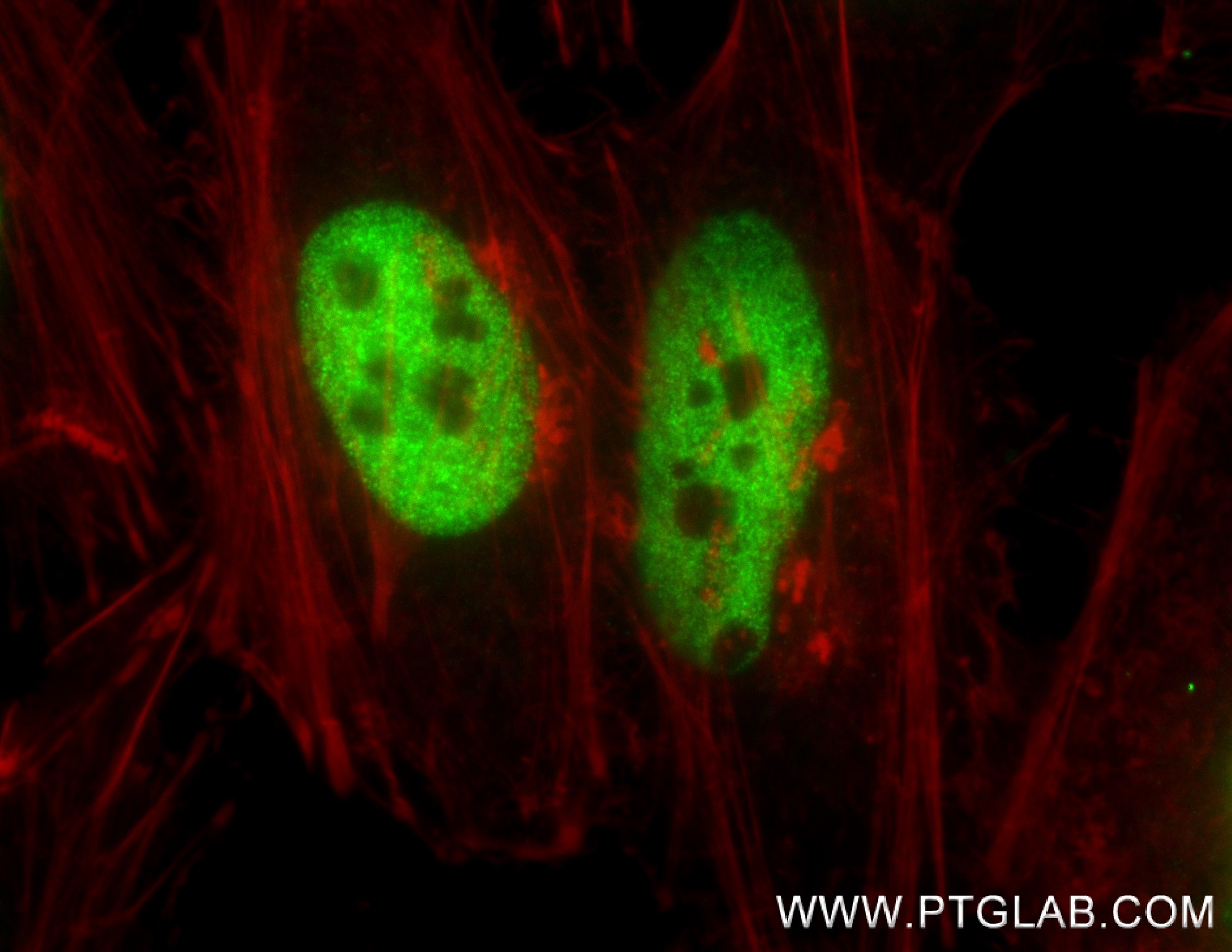 Immunofluorescence (IF) / fluorescent staining of HeLa cells using HDAC1 Recombinant antibody (83624-1-RR)