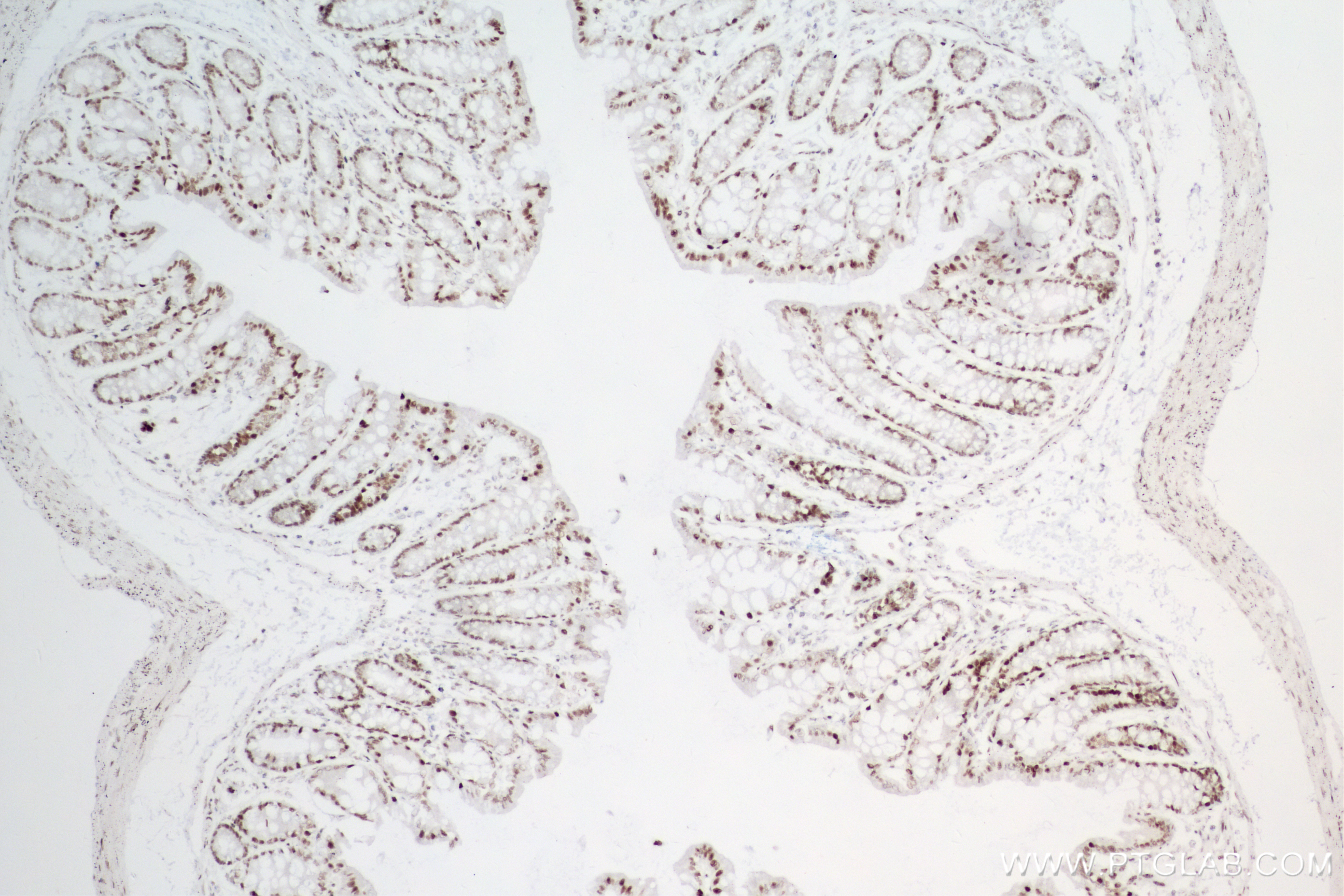 Immunohistochemistry (IHC) staining of mouse colon tissue using HDAC1 Recombinant antibody (83624-1-RR)