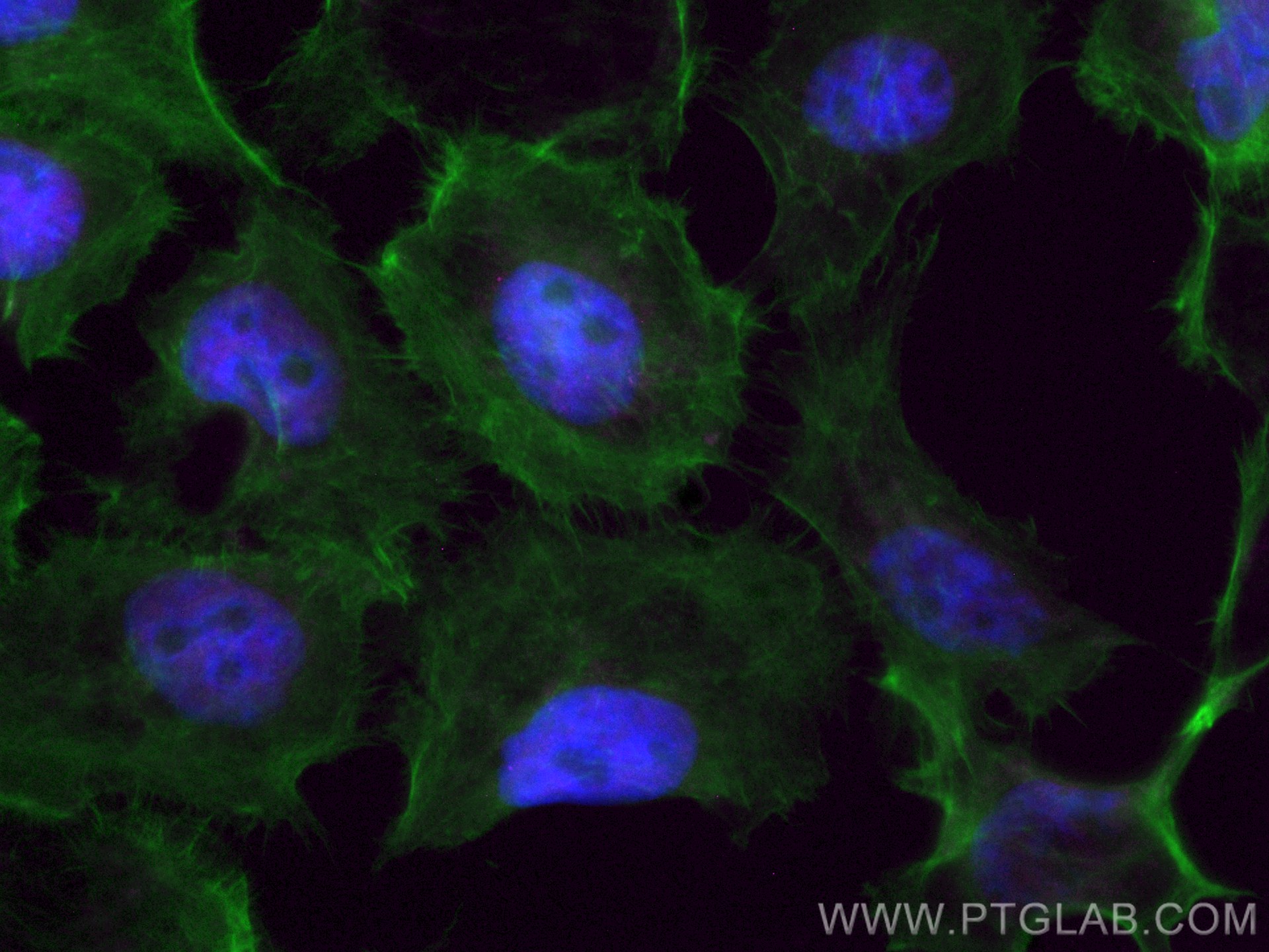 Immunofluorescence (IF) / fluorescent staining of A431 cells using CoraLite® Plus 647-conjugated HDAC1 Monoclonal ant (CL647-66085)