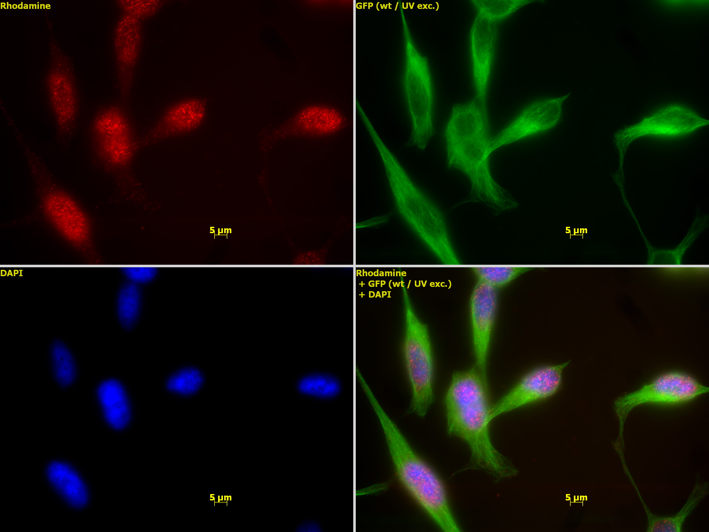 HDAC1 antibody (mAb) (Clone 10E2) tested by immunofluorescence. Top left: HeLa cells stained with HDAC1 antibody (mAb) (Clone 10E2) (1:1,000). Top right: Same cells stained with alpha Tubulin mAb (Clone 5-B-1-2). Bottom left: Same cells stained with DAPI. Bottom right: Merge of all 3 images.