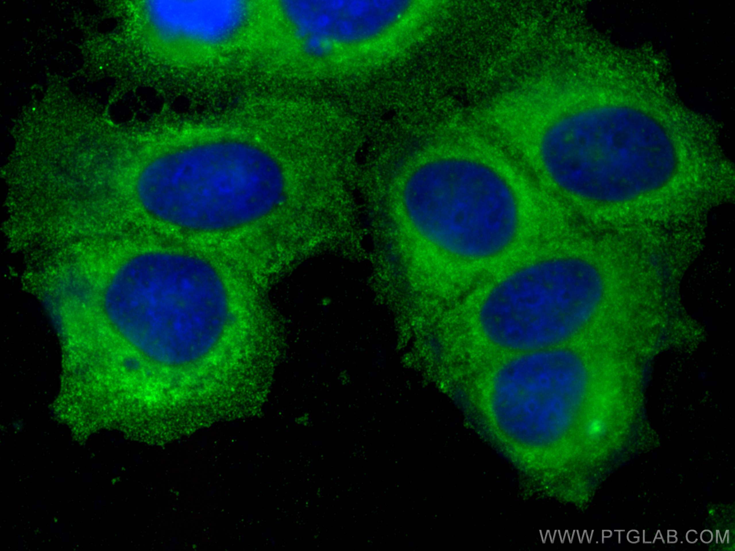 Immunofluorescence (IF) / fluorescent staining of MCF-7 cells using HDAC10 Monoclonal antibody (67646-1-Ig)